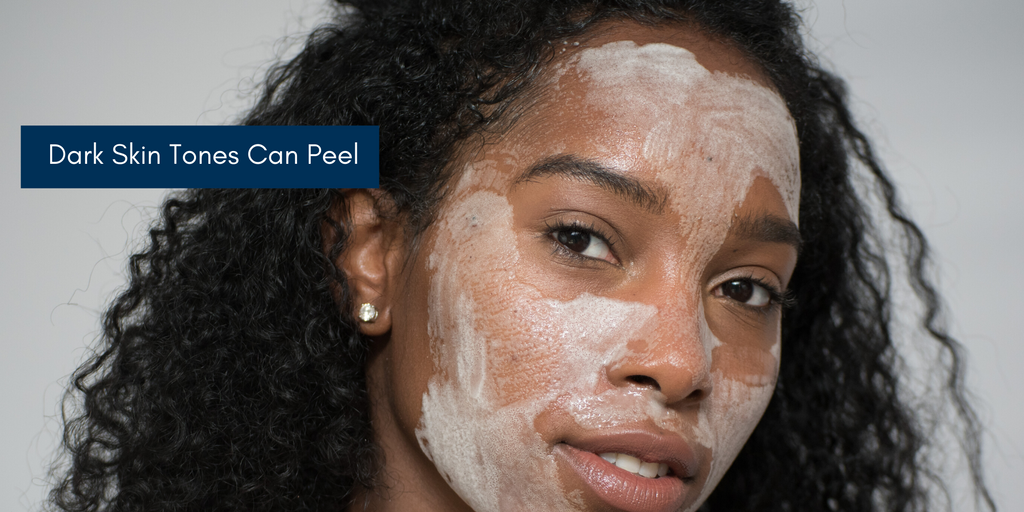 Darker Skin Tones Can Benefit From Skin Peels Too